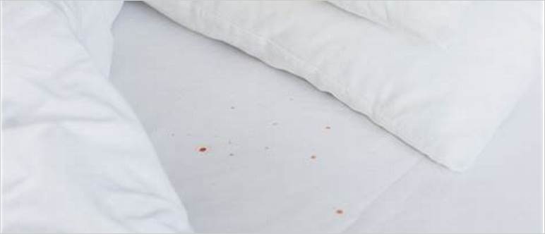 Bed bugs white sheets